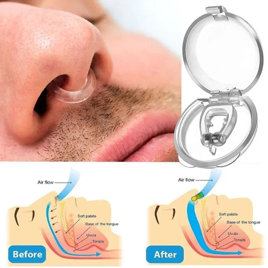 Anti-Snoring Gadget